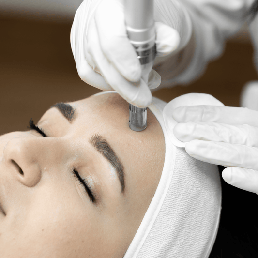 Tratamiento Facial con Dermapen dermapen
